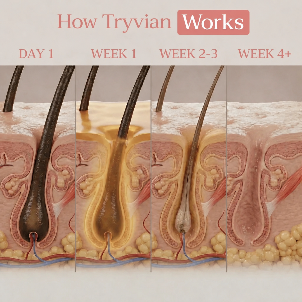 Cyperus Rotundus Oil for Reducing Unwanted Hair